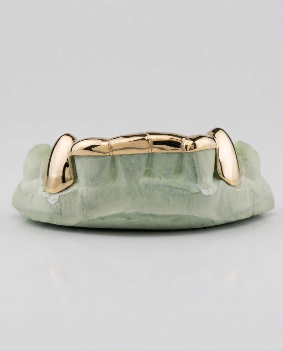 Custom Fit — Fangs, Yellow Gold