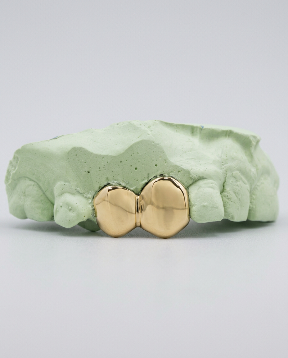 Custom Fit — Double Cap, Yellow Gold
